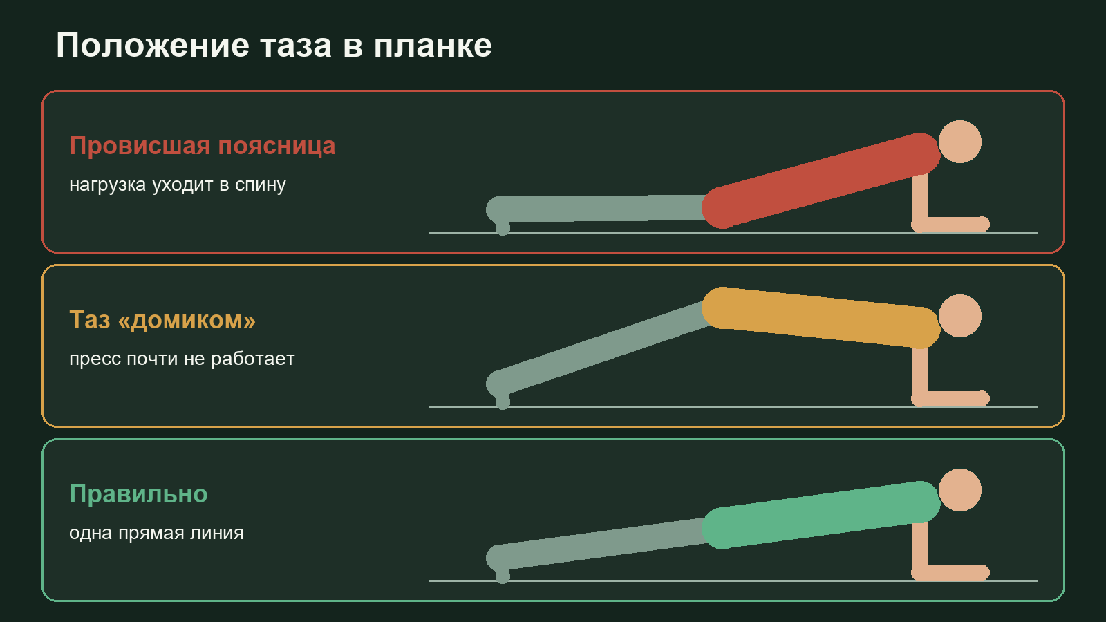 Схема трёх положений таза в планке: провисшая поясница, поднятый таз домиком и правильная прямая линия тела